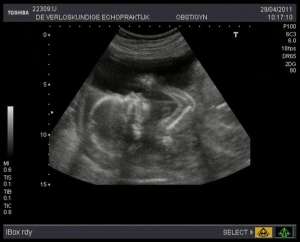 Ons wondertje Zwaaien naar papa en mama =)