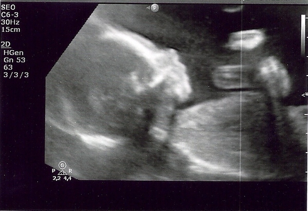 20 weken wonder Ons kleine wondertje!