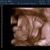 ons wondertje 3D echo van ons wondertje, 29 weken. 