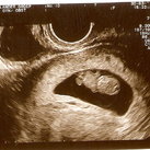 9 Weekjes zwanger van ons wondertje..!! 