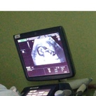  12weken echo