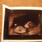 14 weken  zwanger (L)