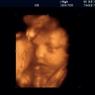 Pretecho met 31 weken en 2 dagen zwanger  Ons lieve moppie had der oogjes dit keer open, echt fantastisch ...  