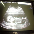 sec.born's eerste echo Eerste echo gemaakt op woensdag 17 september 2014, dat is mij een levendige baby bleef geen moment rustig gelukkig is alles ok 