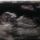baby baby
