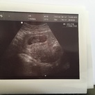 Eerste echo!  