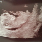 termijnecho 11.3 wk ons wondertje!