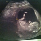 1e trimester scan 1e trimester scan. Alles compleet, alles goed!