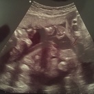 Baby geslacht 20ste week ego