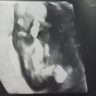 Babygirl 12+3 4D echo kleine prinses