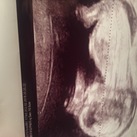  Hallo,

Dit is een foto van onze spruit op 12 weken en 5 dagen. Welk geslacht denken jullie dat het is volgens de nub theorie?

Groetjes