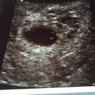 5.5 week 