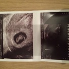 Eerste echo Eerste echo op 20/3/2018 alles is perfect