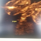 Jongen? 19 weken echo