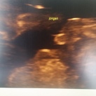 Jongen?2 