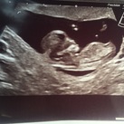 11 wk 3 dagen  