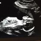 Boy or girl  Wat denken jullie? :) 