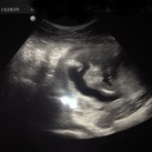 16 weken Dit is de echo met 16 weken en volgens de echoscopiste 100% een jongen! 