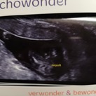 It's a boy!! 