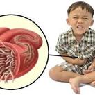 worm infections in children worm infections in children