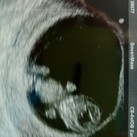 babytjes babytjes