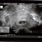 Kleintje 8,5 week zwanger