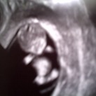 Hoera zwanger! Hier een van de eerste foto. Zo klein als het is, maar alles zit er al op en aan, bij 12 weken zwanger!!