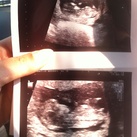  11 weken en 4 dagen! 