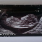 echo De eerste echo bij 10 weken en 6 dagen.