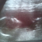 week 17 