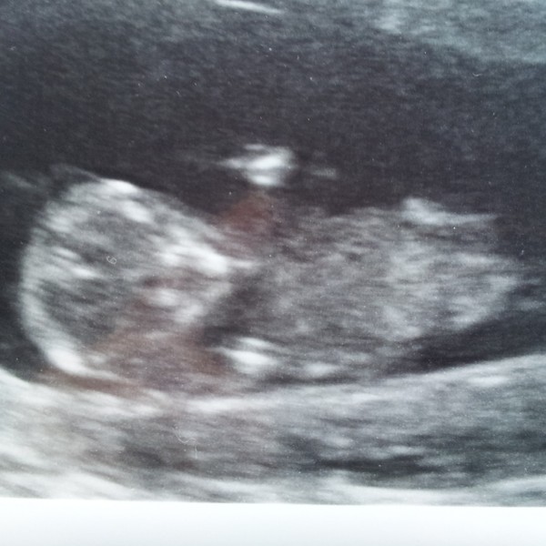 Ons wondertje ♥ Echo van 11 weken en 3 dagen ♥