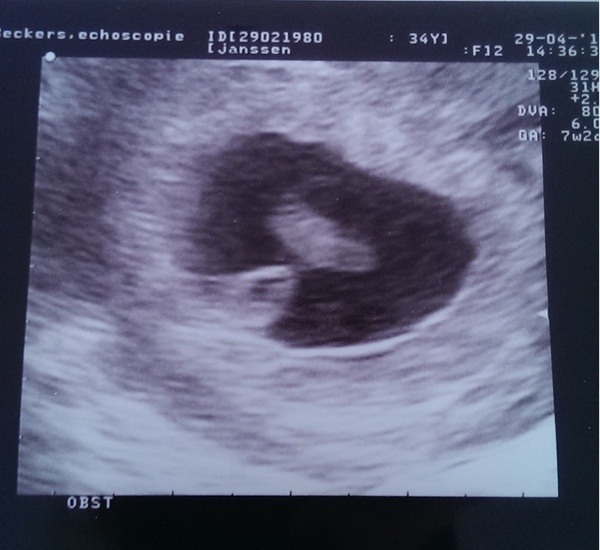 Eerste echo!  Onze frummel met 7 weken 2 dagen