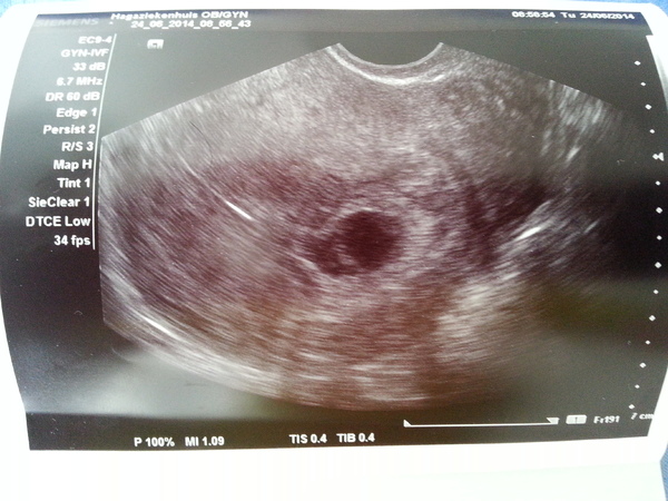 24.06.2014 Echo 7w4d kloppend ♡ gezien!