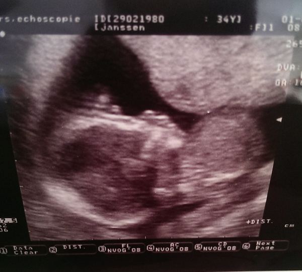 16 weken, 1 dag ons meisje!! I'm a girl!!