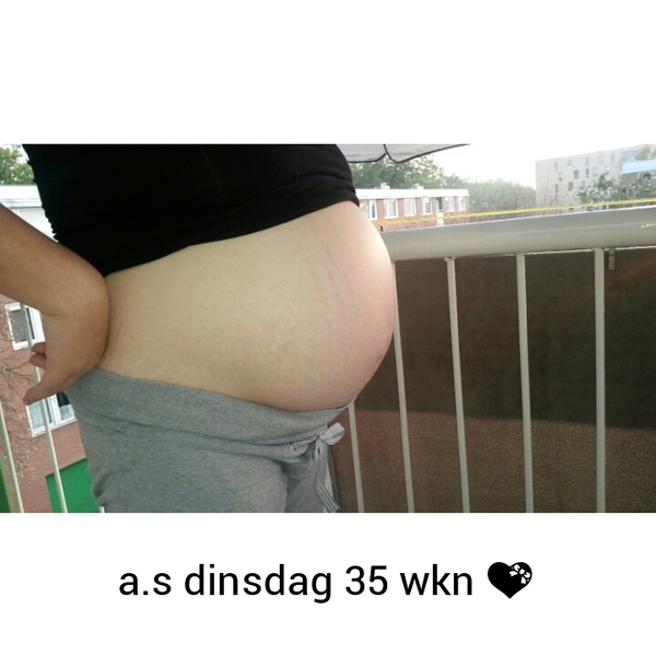 bijna 35 wkn zwanger 35 Wkn