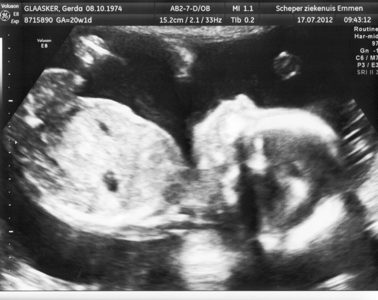 Onze dochter 17-07-2012! 