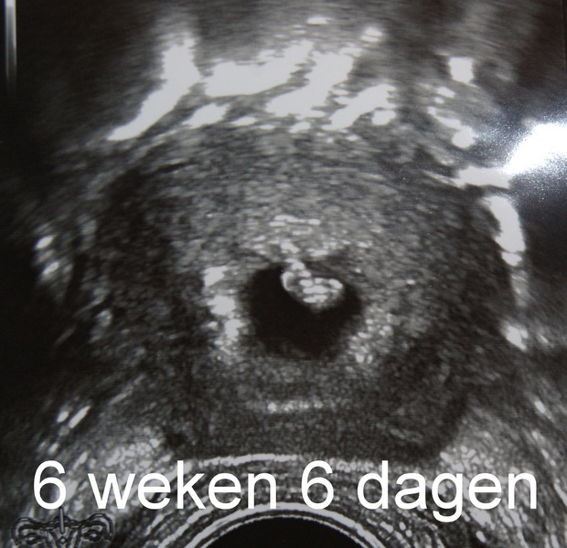 ons ukje eerste echo op 3 augustus 2012 6 weken en 6 dagen