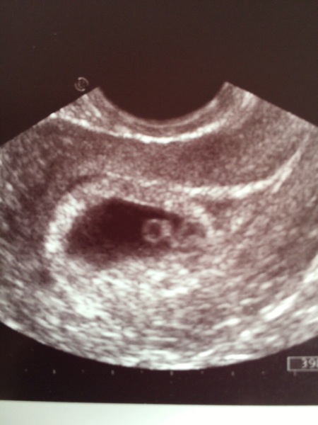 Eerste foto van Baby Bem 