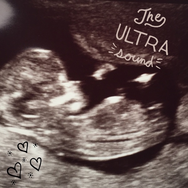 Ultrasound 