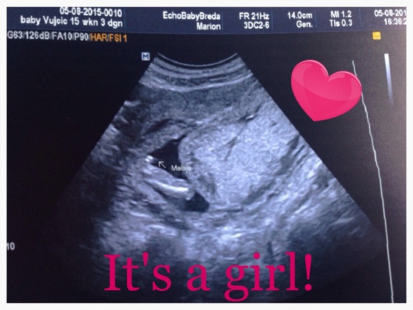  its a girl!