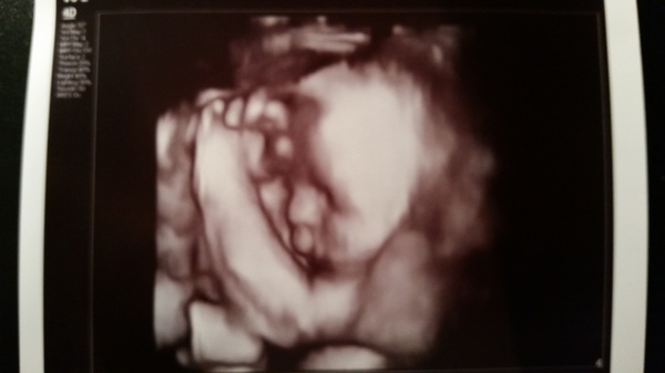 27 wk 