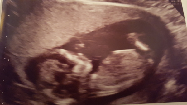 mijn baby 