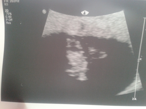 echo 7 weken <3 