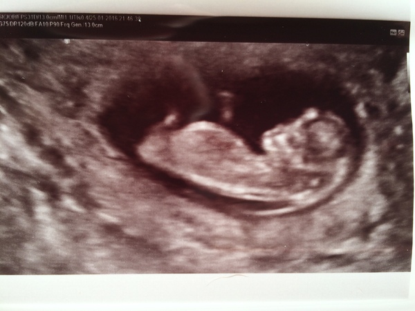 Baby2 10w6d