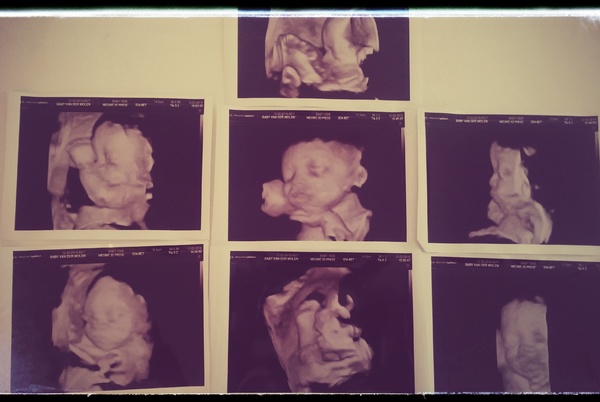  Onze babyboy in 3d/4d 
