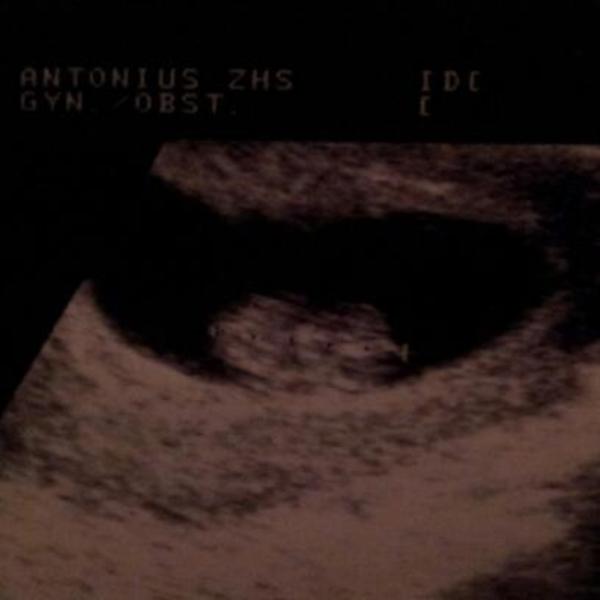 echo 9w2d 