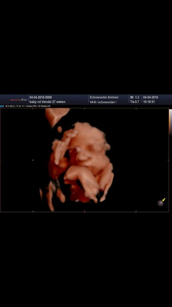 Our baby boy  Lekker aan sabbelen op ze handje! 