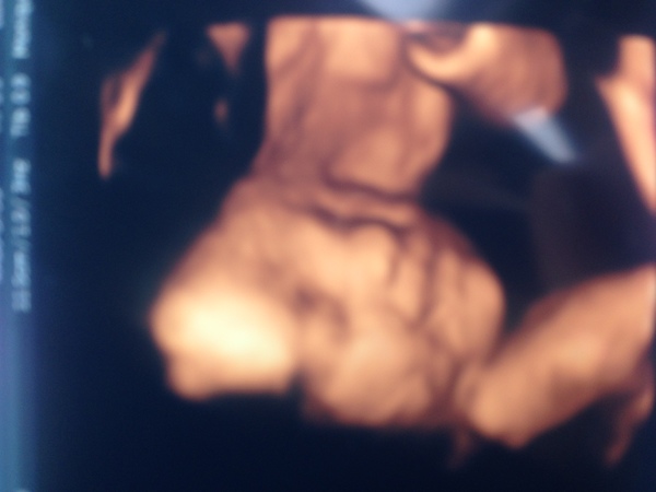  Hallo mama's ik ben 32 en ik ben 34weken zwanger van mijn vijfde kindje...lijkt mij gezellig om met andere aanstaand/mama's te babbelen groetjess
