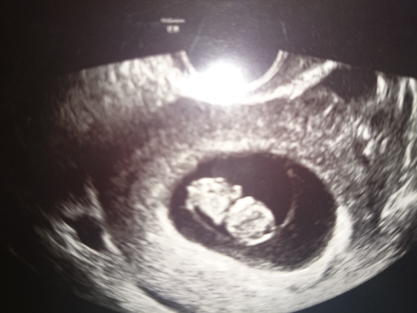 Echo week 8 