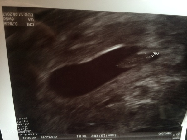  Eerste echo 6w 5d